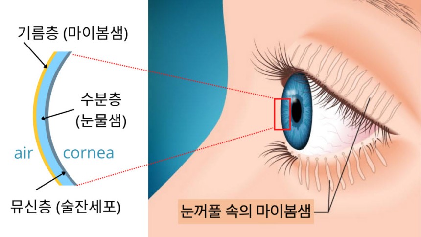 My research on Automated MGD Assessment Got Featured on South Korea's Largest Online News Portal